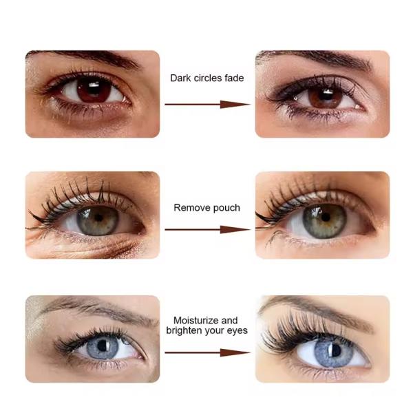 Ageless Eye Cream for Instant Eye Bag Removal Anti-Wrinkles Firming Lifting Beauty Snake Venom OEM Dark Cream